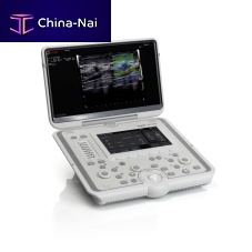 Portable ultrasound system MyLabOmegafor multipurpose ultrasound imaging3D/4Dcolor doppler