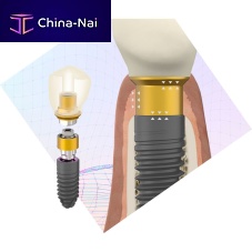 Cylindrical implant abutment BioBlock®titaniumexternalstraight
