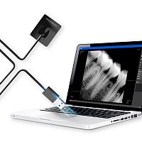 Dental radiography intra-oral detector XV 100