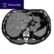 Medical software medical imagingfor researchtreatment