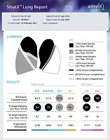CT software StratX®analysisreportingmeasurement