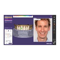 Medical software ChairsideCADclinicalfor dental laboratoriesfor dental restorations
