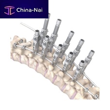 Thoraco-lumbar osteosynthesis unit RESPONSE 5.5/6.0posteriorpediatric