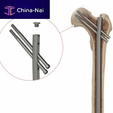 Femoral intramedullary nail 4T1-4001050proximal fixation
