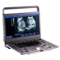 Portable ultrasound system DUS � 5000 +for gynecological and obstetric ultrasound imagingfor abdominal and pelvic ultrasound imagingfor cardiovascular ultrasound imaging