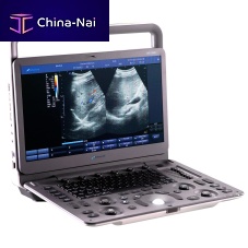 Portable ultrasound system DUS � 5000 +for gynecological and obstetric ultrasound imagingfor abdominal and pelvic ultrasound imagingfor cardiovascular ultrasound imaging