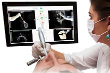 Dental surgery surgical navigation system optical