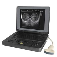 Portable ultrasound system YSB3000Wfor multipurpose ultrasound imagingfor gynecological and obstetric ultrasound imagingfor breast ultrasound imaging