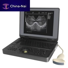 Portable ultrasound system YSB3000Wfor multipurpose ultrasound imagingfor gynecological and obstetric ultrasound imagingfor breast ultrasound imaging