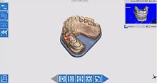 Scan software OPTORLdentalacquisitionCAD