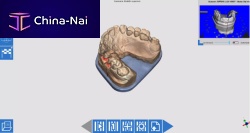 Scan software OPTORLdentalacquisitionCAD