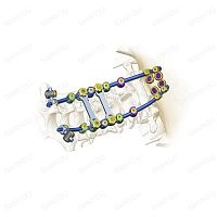 Occipito-cervical osteosynthesis unit Cervina®posterioradult