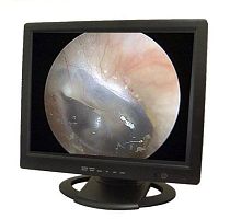 Endoscopy display PROVIEW 1919"LCD