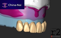 Dental software BiteReg designmodelingimport