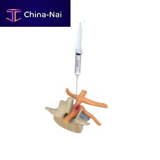Gel adhesion barrier BETAMIXabdominal laparotomypelvic laparotomycesarean surgery