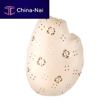 Custom-made cranial implant evoShape