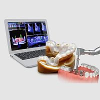 Guided surgery software Implant3Dfor dental implantologyanalysis3D viewing
