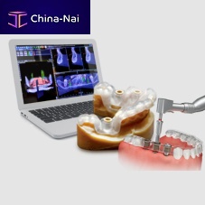 Guided surgery software Implant3Dfor dental implantologyanalysis3D viewing