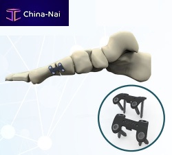 Hallux valgus arthrodesis plate FRC20 serieslockingmetallic