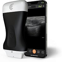 Hand-held ultrasound system L7 HD3for breast ultrasound imagingfor emergency medicine ultrasound imagingfor musculoskeletal ultrasound imaging
