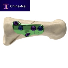 Hallux valgus osteotomy plate Axi+Line®metatarsal boneproximallocking