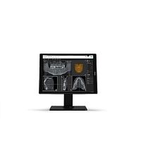 Diagnostic display MDNC3521 DEdental21.3in4:3