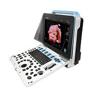 Color doppler ultrasound system DW-P30portablefor multipurpose ultrasound imagingfor emergency medicine ultrasound imaging