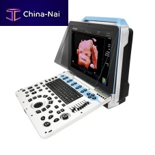 Color doppler ultrasound system DW-P30portablefor multipurpose ultrasound imagingfor emergency medicine ultrasound imaging