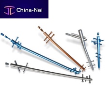 Humeral intramedullary nail tibiafemurproximal fixation