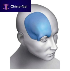 Custom-made cranial implant Matrix Omnipore®