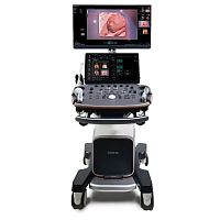 On-platform ultrasound system Imagyn I9for gynecological and obstetric ultrasound imagingB/Wcolor doppler
