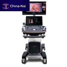 On-platform ultrasound system Imagyn I9for gynecological and obstetric ultrasound imagingB/Wcolor doppler