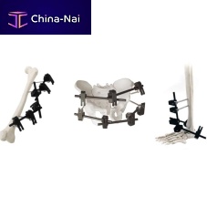 Modular external fixation system QuickX tubularadult