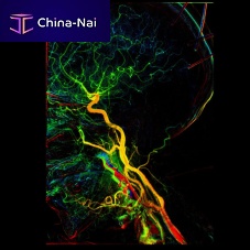 Hospital software KMITangiographyfor neuroimagingvascular surgery