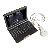 Multipurpose ultrasound imaging system Arterial DopplerportableB/Wcolor doppler