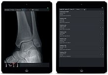 Medical imaging iOS application mOpalfor PACSvisualizationiOS