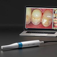 Intraoral camera D-CAM HDSanalogHD2560 x 1920