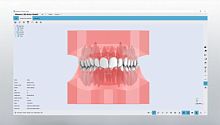 CAD software Studioorthodonticfor dental laboratoriesdental