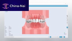 CAD software Studioorthodonticfor dental laboratoriesdental