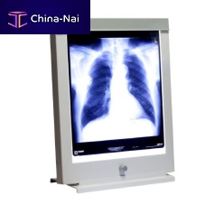 1-screen X-ray film viewer 2-screen3-screen4-screen