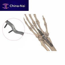 Wrist arthrodesis plate AS.W.074dorsallockingnon-locking