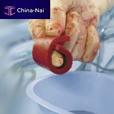 Xenograft bone substitute Cerasorb® Foamfor orthopedic surgerymalleable