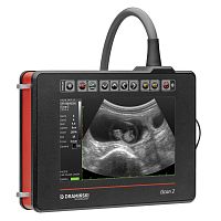 Portable veterinary ultrasound system iScan 2multipurposeB/W