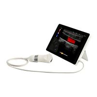 Portable ultrasound system T-Litefor abdominal and pelvic ultrasound imagingfor multipurpose ultrasound imagingfor gynecological and obstetric ultrasound imaging