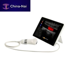 Portable ultrasound system T-Litefor abdominal and pelvic ultrasound imagingfor multipurpose ultrasound imagingfor gynecological and obstetric ultrasound imaging