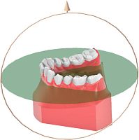 Orthodontic software Maestro 3D orthodentalanalysismeasurement
