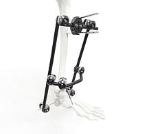 Tibia external fixation system Variisankletubularadult