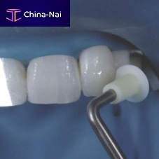 Dental composite modeling instrument NA067