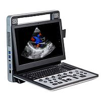 Portable ultrasound system Apogee C5for multipurpose ultrasound imagingfor abdominal and pelvic ultrasound imagingfor cardiovascular ultrasound imaging