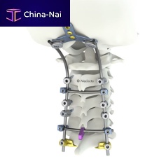 Occipito-cervico-thoracic osteosynthesis unit M.U.S.T. Miniposterioradult